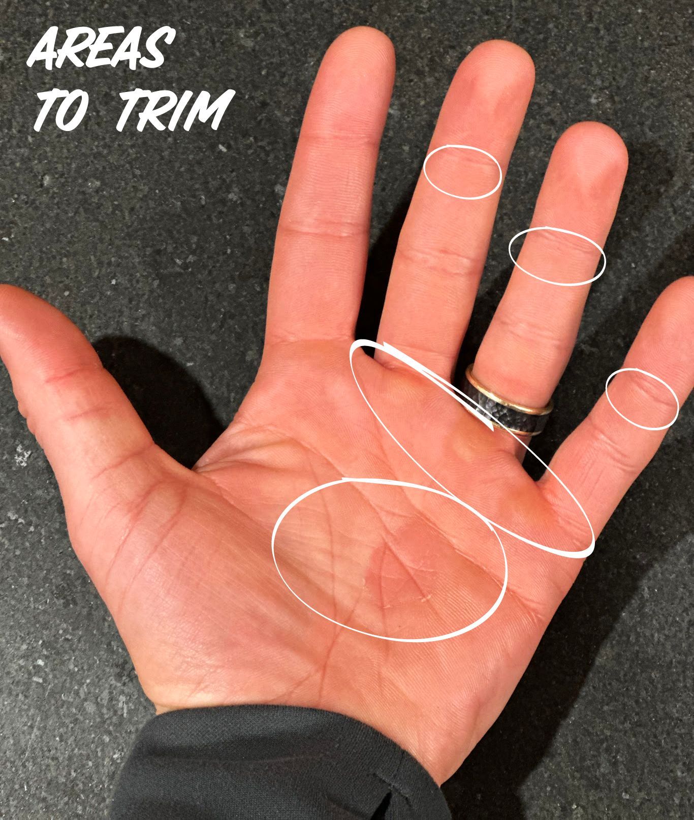 Open palm with white circles marking trim areas on fingers and palm, labeled “AREAS TO TRIM.”