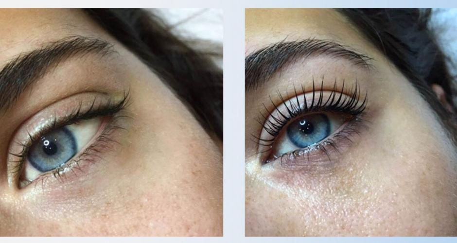Les yeux d'une femme sont montrés avant et après un rehaussement de cils.