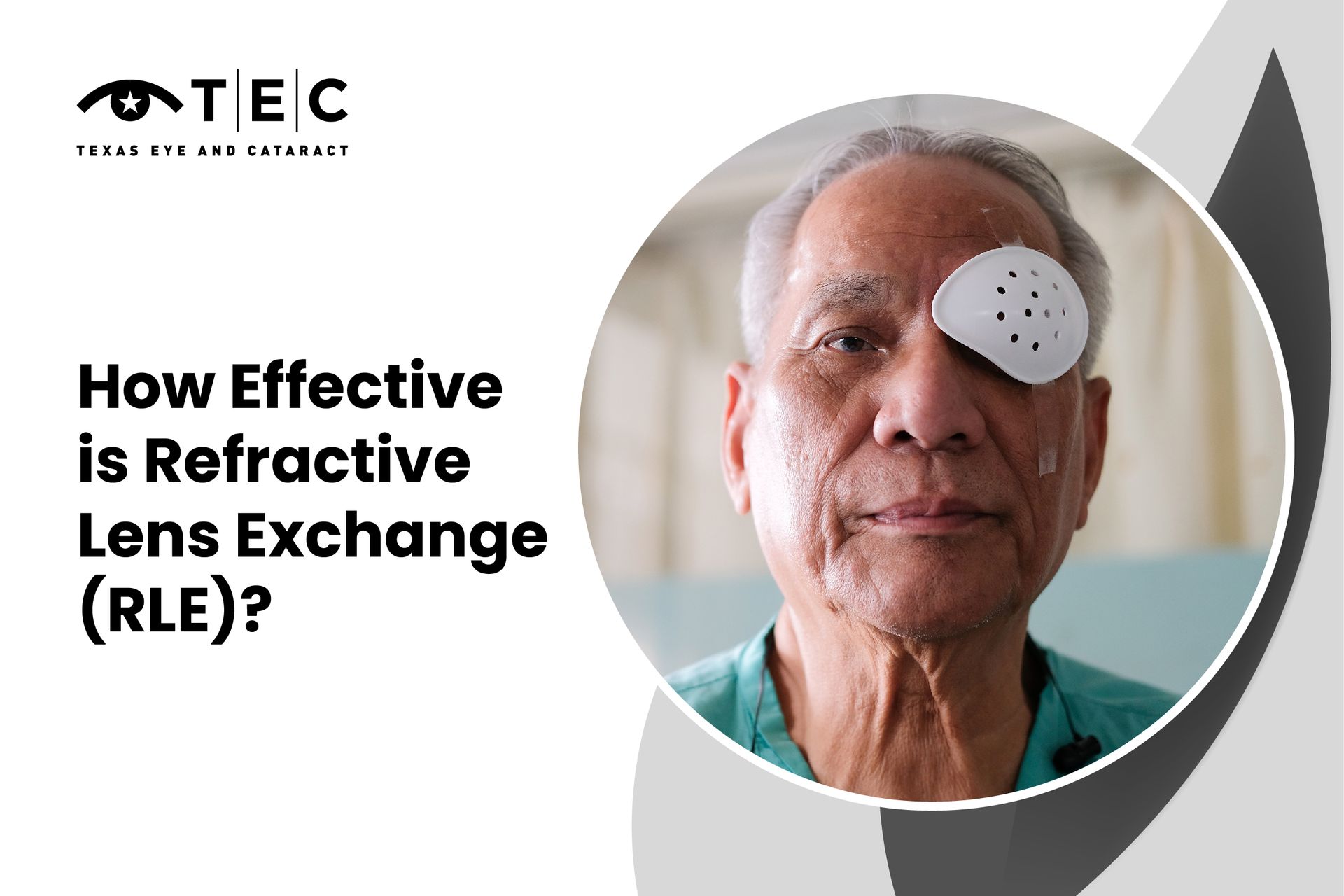 How Effective is Refractive Lens Exchange (RLE)?