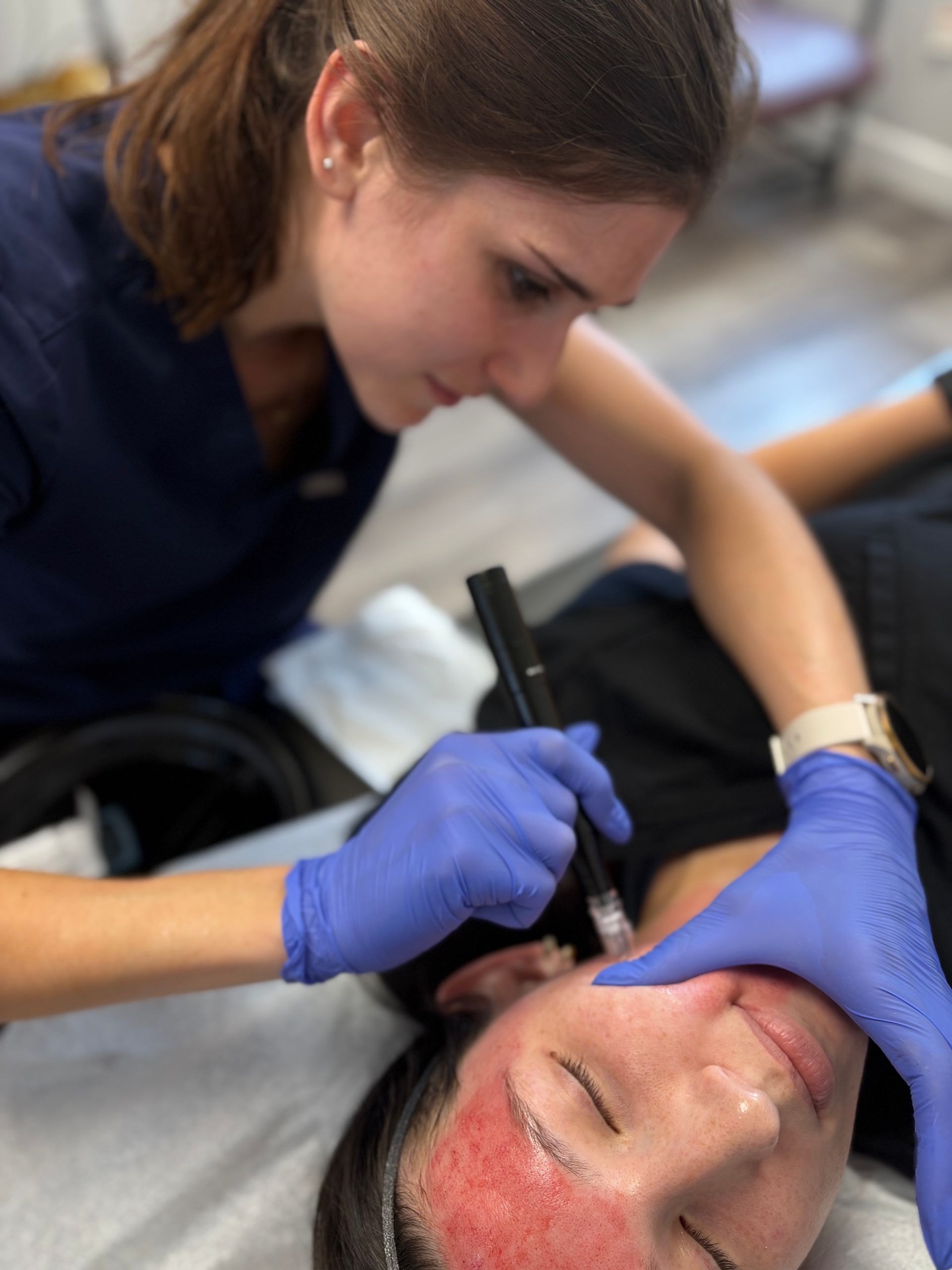 Our team performing an aesthetic treatment at A to Z Wellness in Tampa