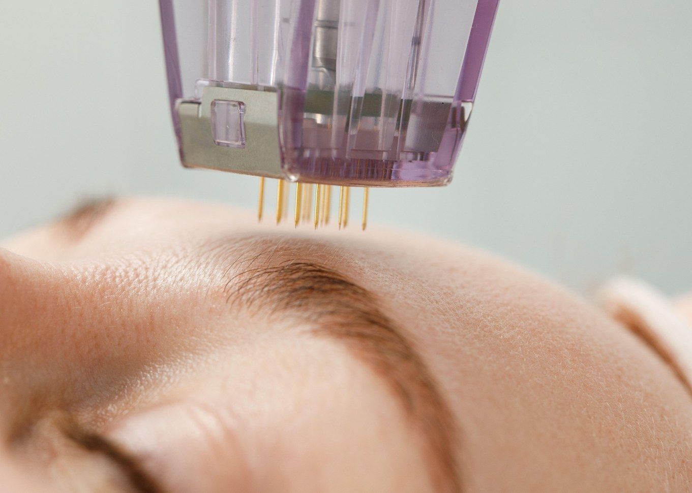 Microneedling device used at A to Z Wellness Tampa