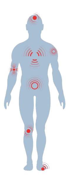 Human Body Pain — North Ryde, NSW — Ryde Physiotherapy Centre Human Body Pain — North Ryde, NSW — Ryde Physiotherapy Centre