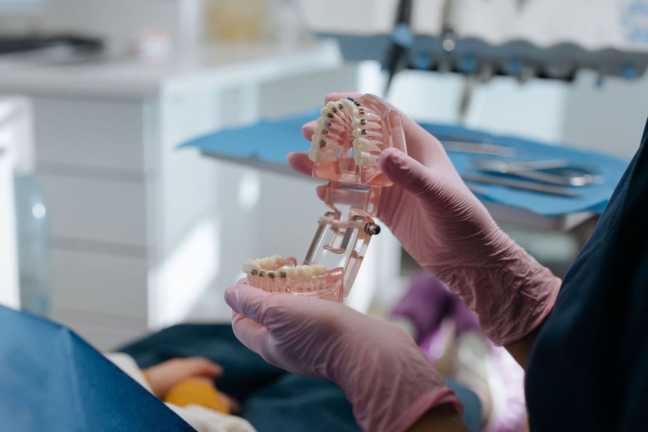 Manos enguantadas sosteniendo un modelo dental con aparatos de ortodoncia en un entorno clínico.