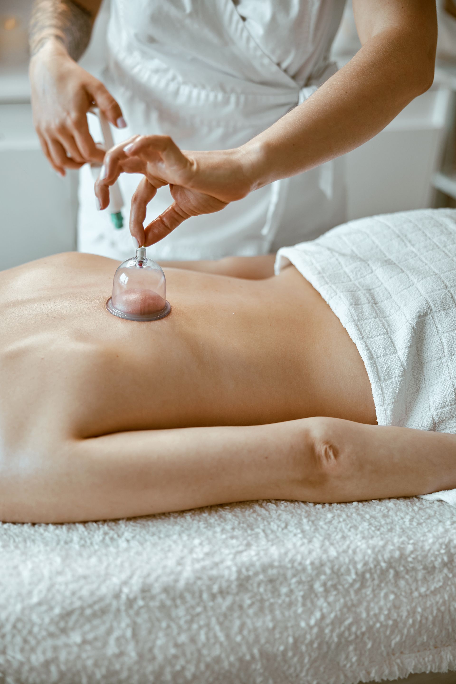 A woman is getting a cupping treatment on her back at a spa.