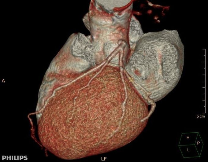 cardiologia