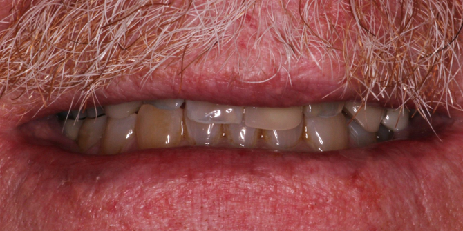 Close-up of a smiling mouth showing white teeth and pink lips