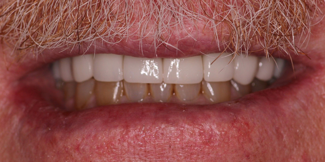 Close-up of a smiling mouth with white teeth and pink lips