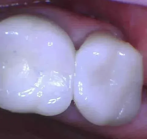 Man smiling at his reflection while adjusting braces in a bathroom mirror