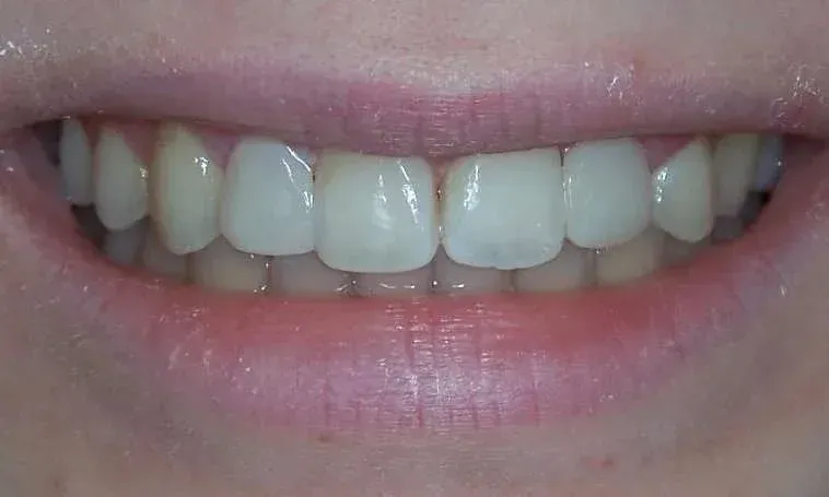 Close-up of a smiling mouth showing straight white teeth and pink lips