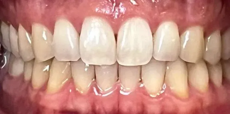 Close-up of a smiling mouth with red lipstick and white teeth