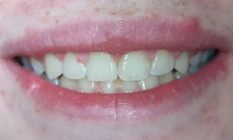 Close-up of a smiling mouth showing teeth with light pink lips