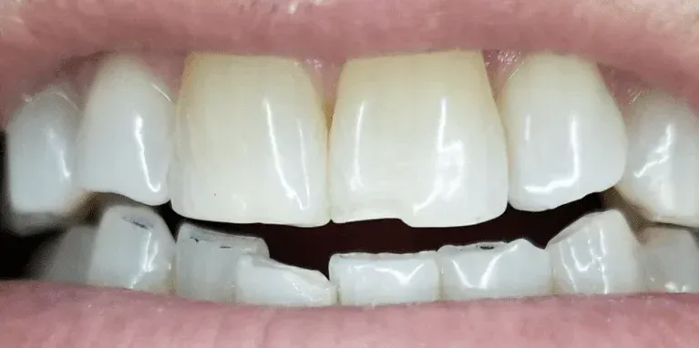 Close-up of a smiling mouth with glossy lips and visible white teeth