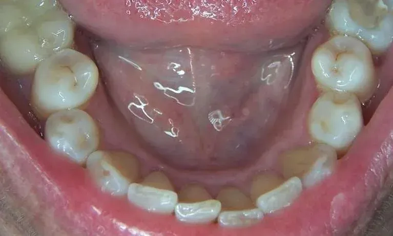 Close-up of a smiling mouth showing white teeth and pink lips