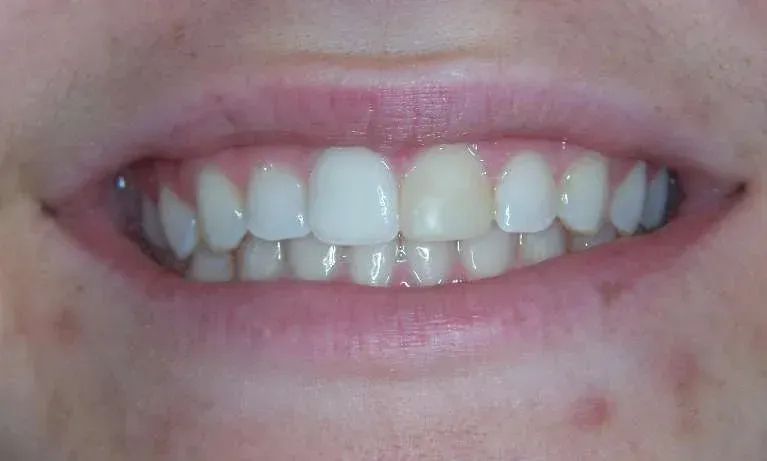 Close-up of a smiling mouth showing teeth and lips