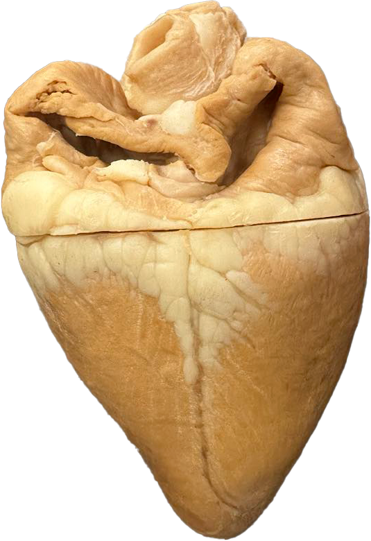 Plastinated Cow's Heart