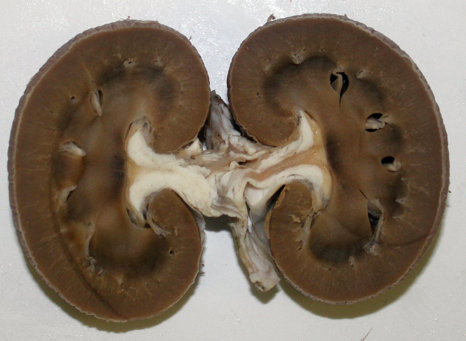 Sagittal Section in the Kidney
