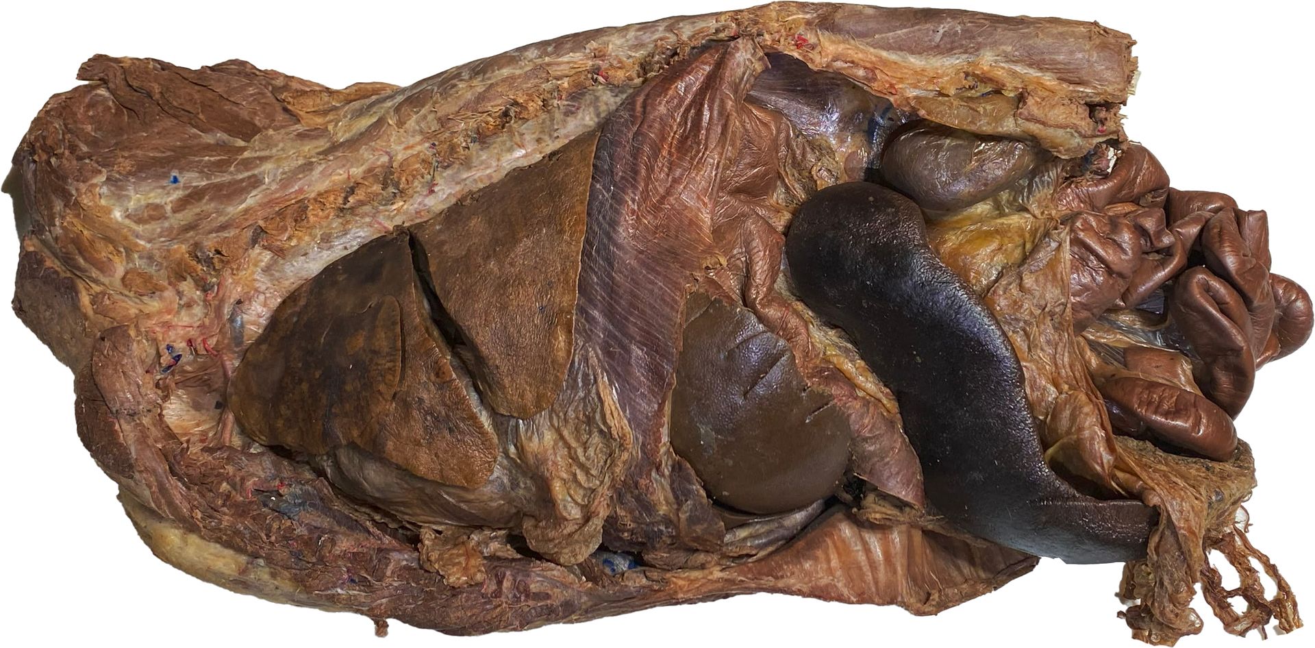 Thorax and abdomen of the dog