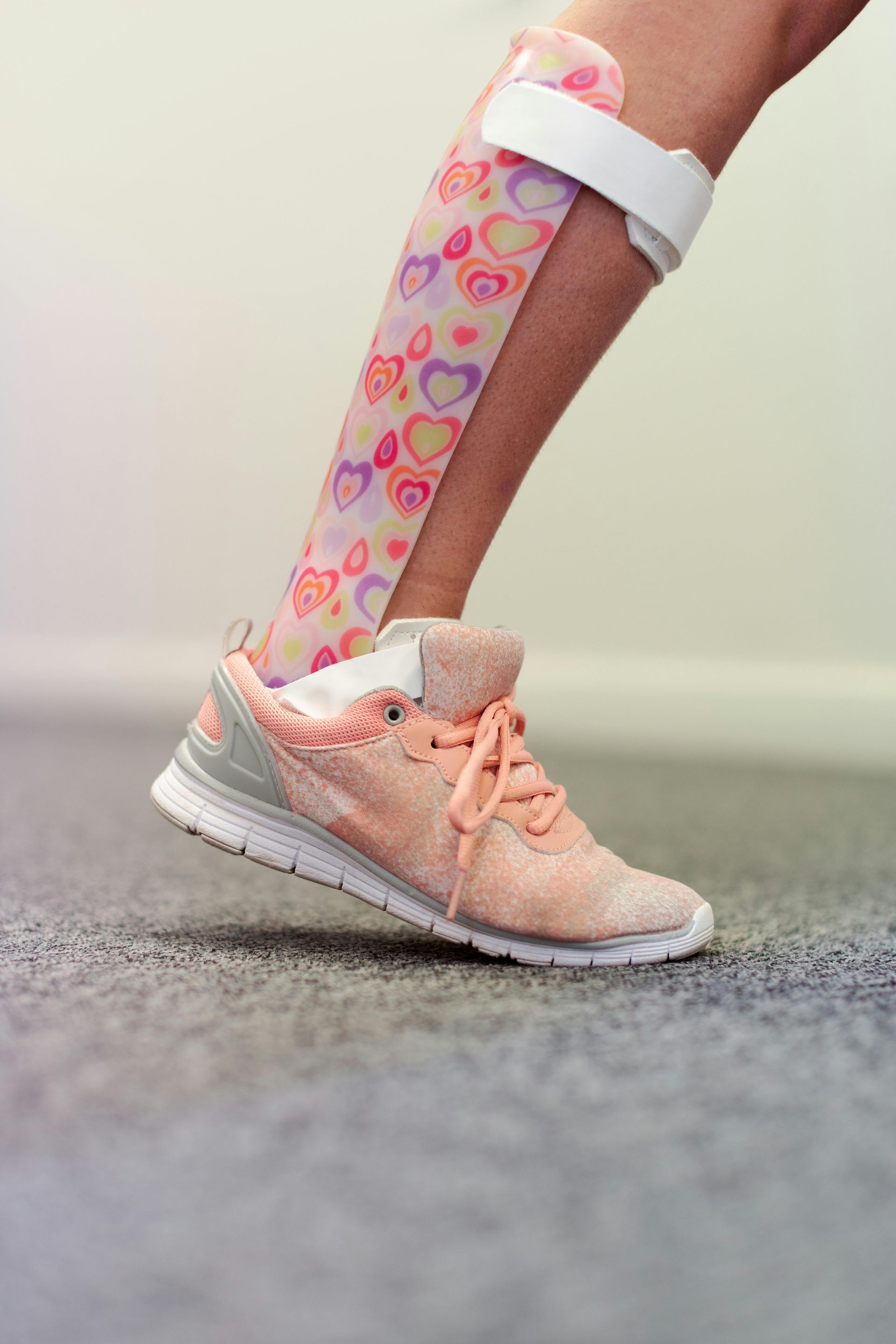 Leg and foot in a patterned pink ankle-foot orthosis and athletic shoe, indoors.