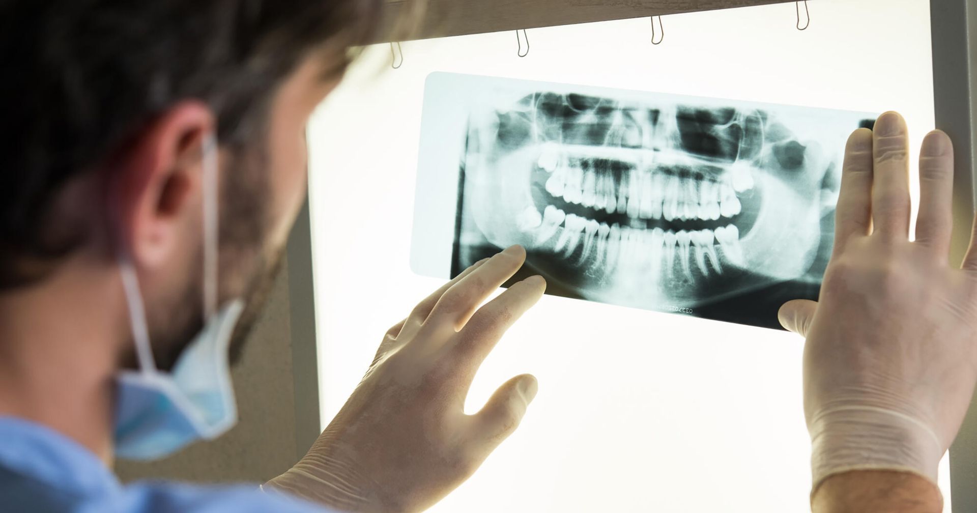 how long will a dental implant last, dentist North Park San Diego CA, dental implants San Diego CA