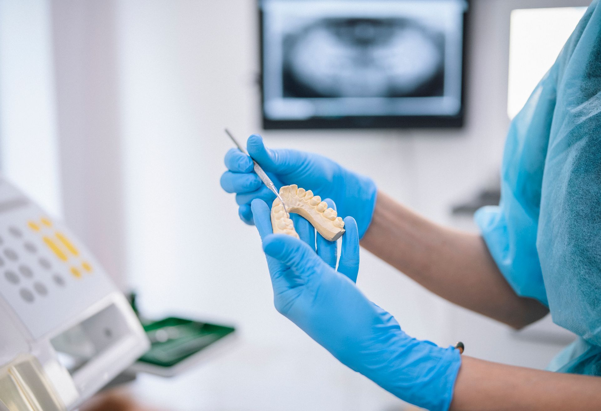 Dental Plaster Mould in the Hands of the Dentist — Mount Waverley, VIC — Mount Waverley Dental