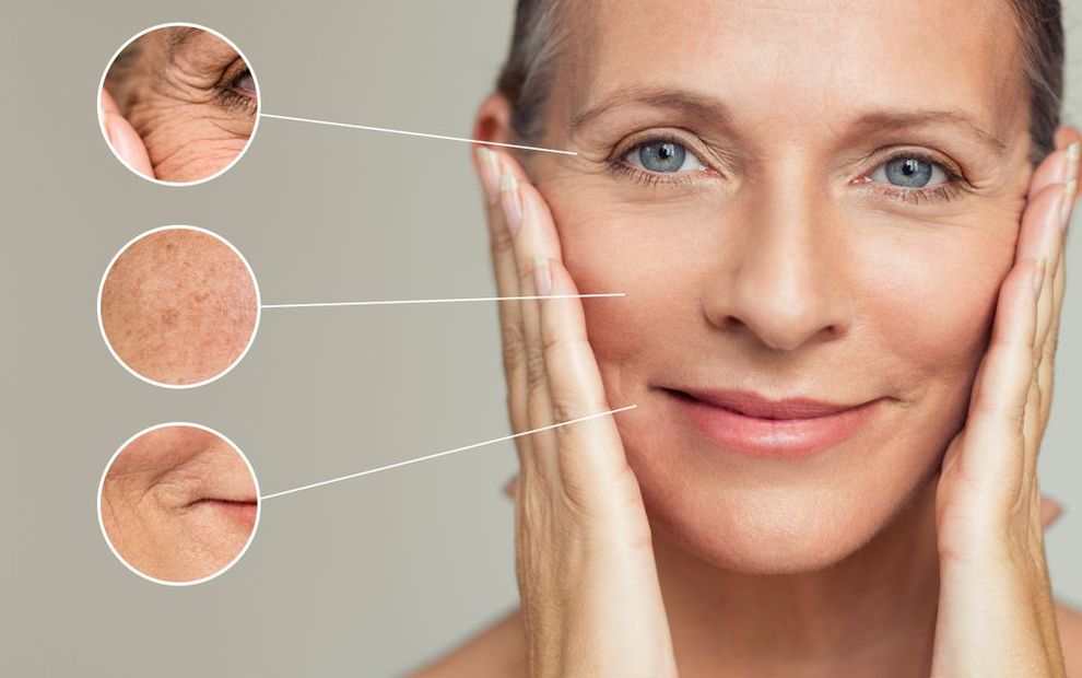 Woman touching face, with close-ups of aging skin: wrinkles around the eyes and mouth, age spots.