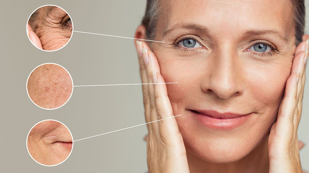Woman holding face, close-up with magnified circles of wrinkles and skin damage.
