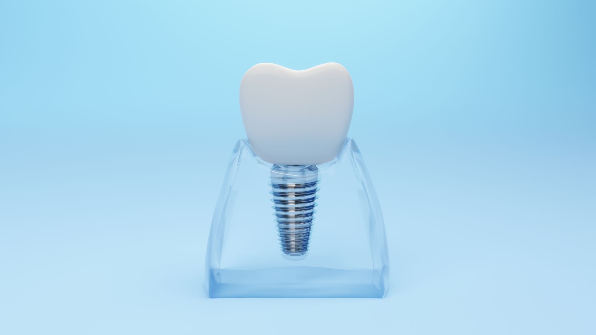 Dental implant model on a light blue background, showing a white tooth with a metal screw root