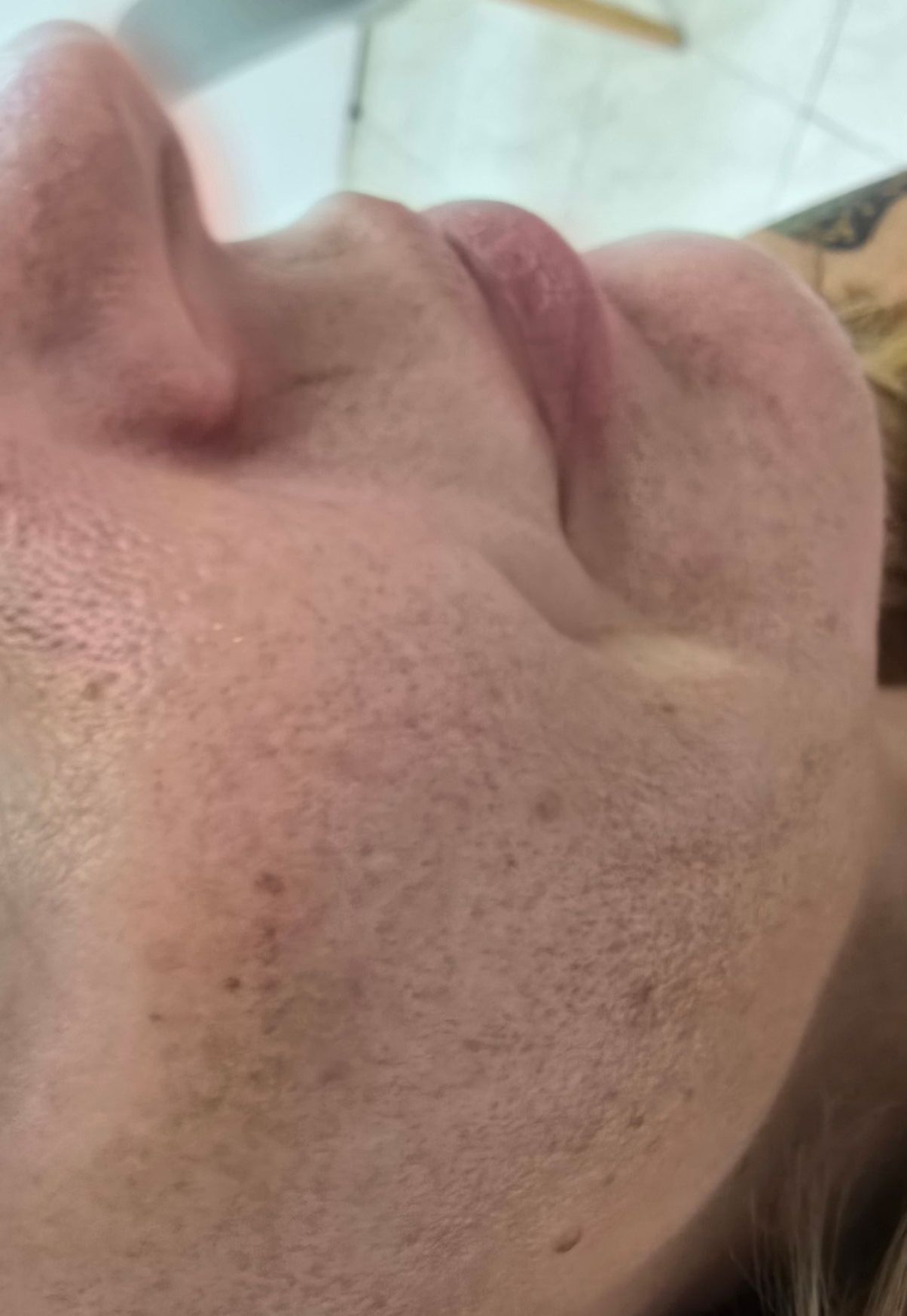 Primer plano del rostro de una persona, mostrando la nariz, los labios y la mejilla. La piel presenta pecas.