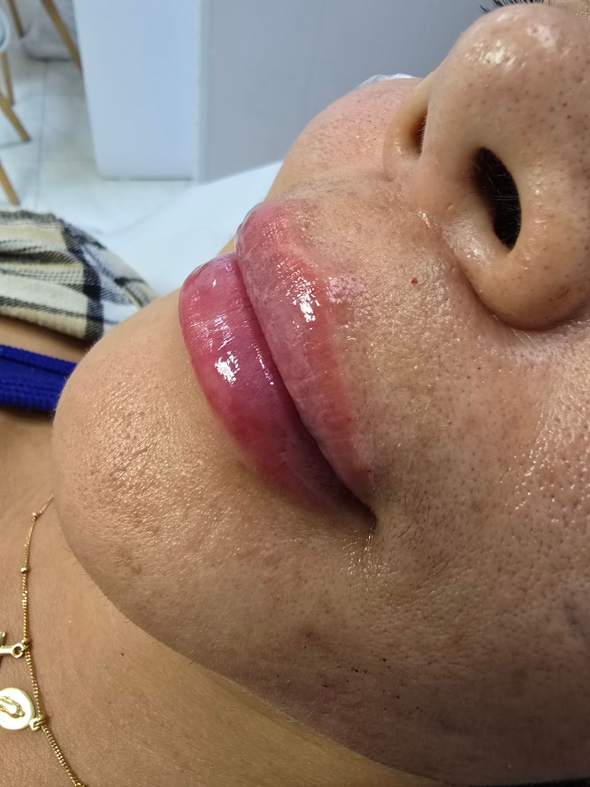 Primer plano del rostro de una persona con labios brillantes y carnosos. Su piel tiene un ligero brillo y está recostada de lado.