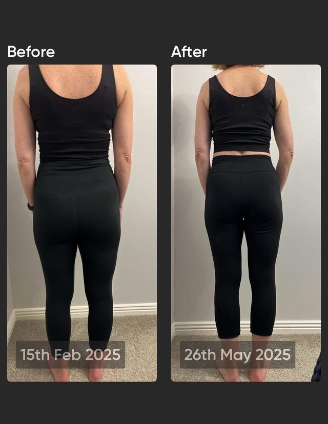 Before and after.