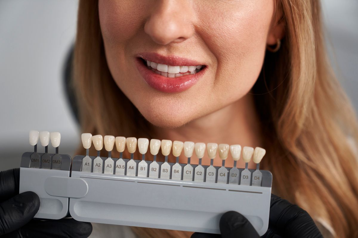 Dentist holding a tooth shade guide near a smiling mouth, comparing tooth colors.