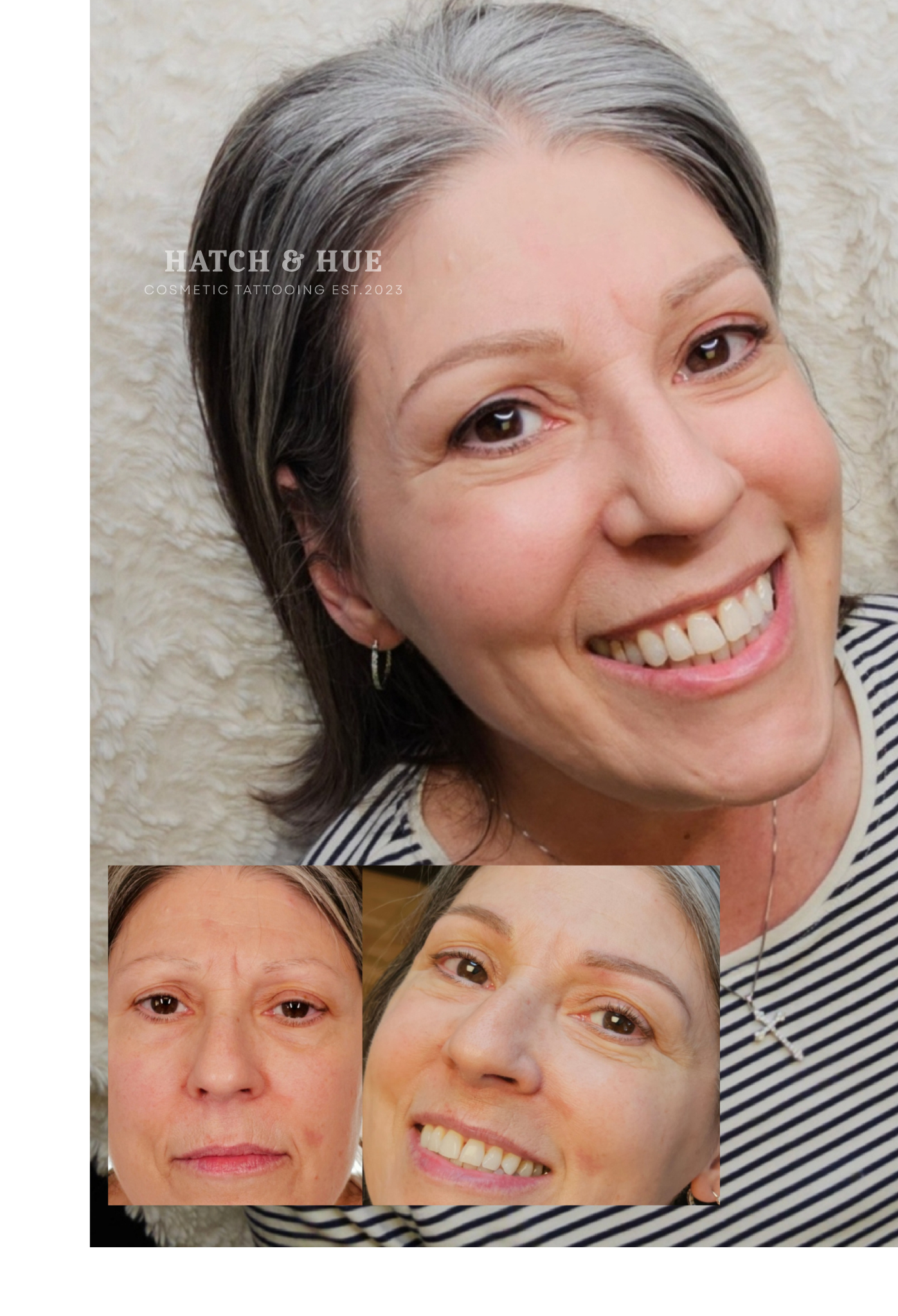 Woman with gray hair smiles, inset photos show before/after skin treatment.