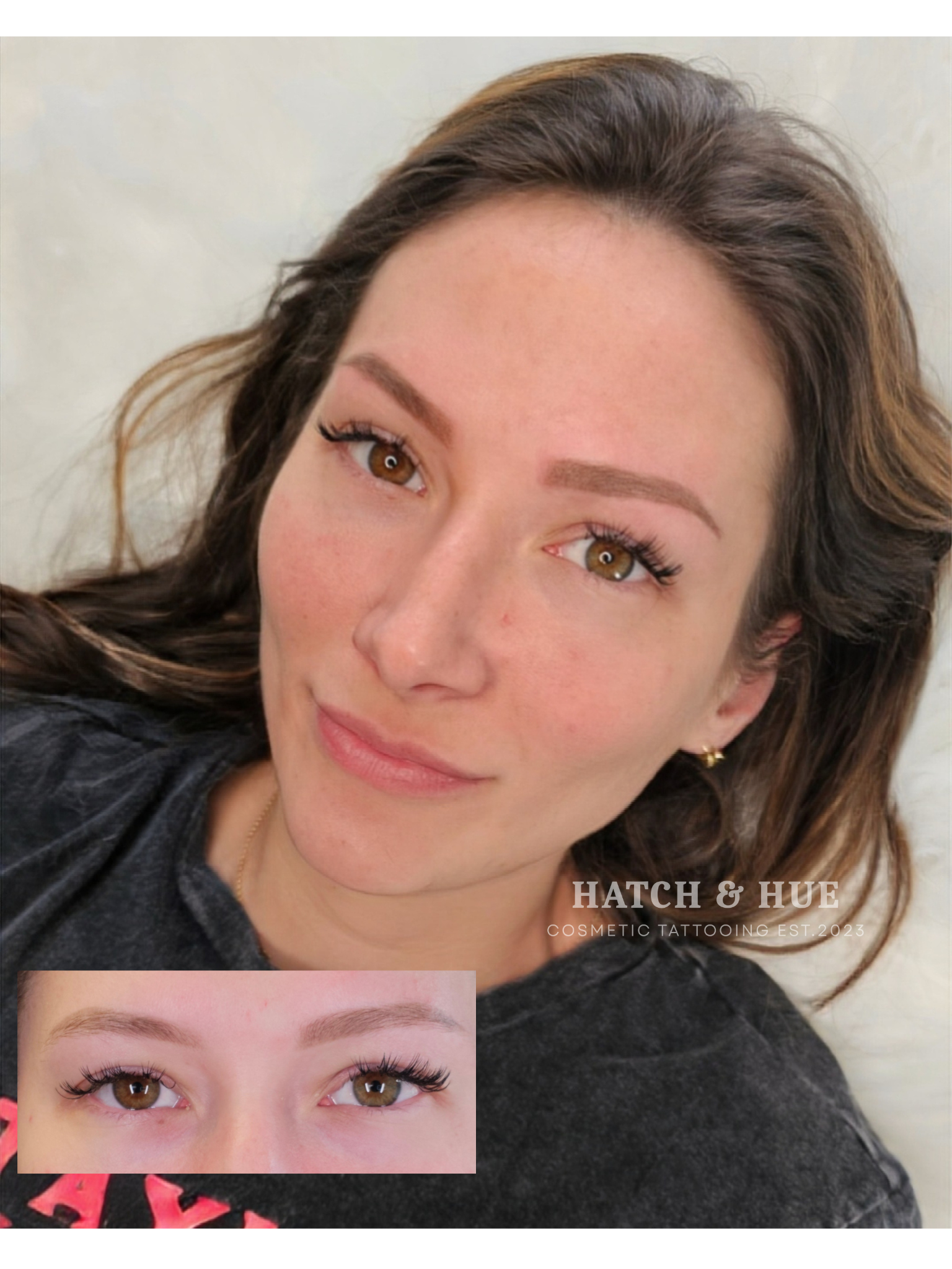 Woman with cosmetic eyebrow procedure, inset before/after photo.