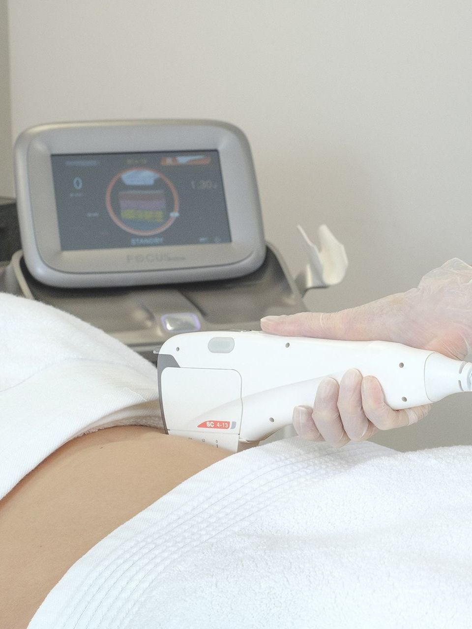 High Intensity Focused Ultrasound (HIFU) | Ashover Laser & Skin Clinic Near Matlock