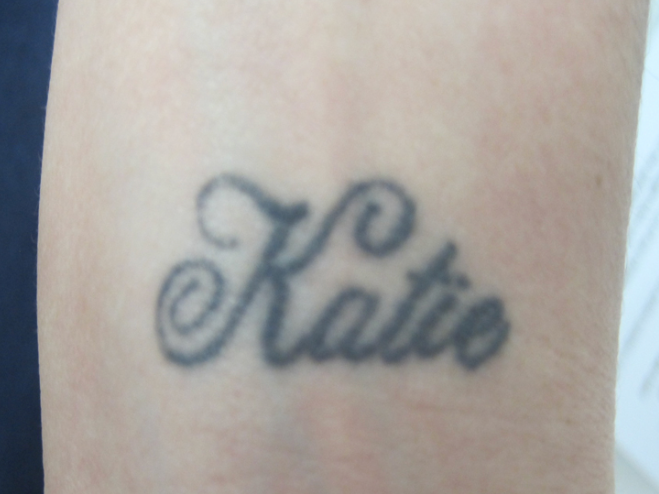 Laser tatto removal