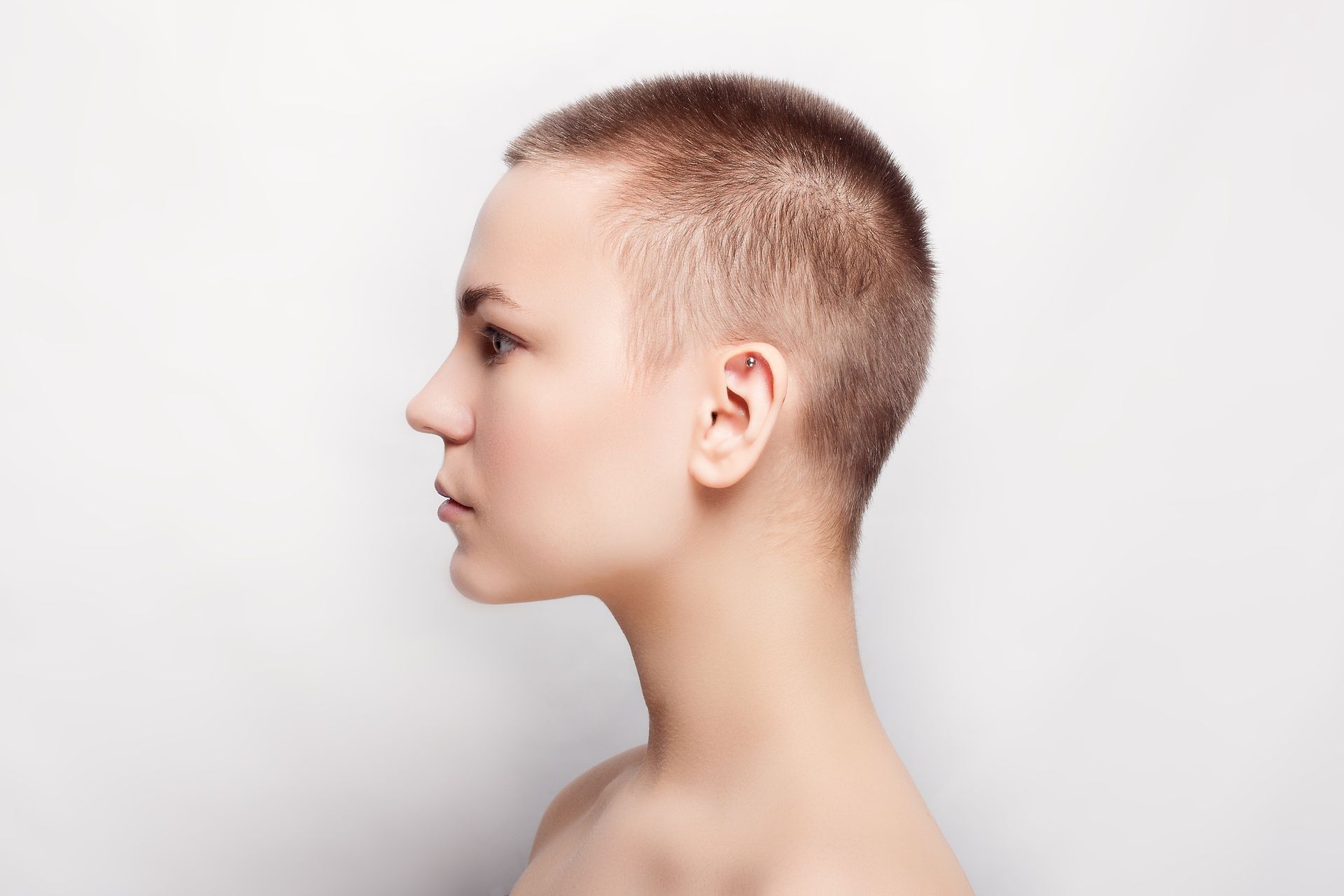 Minimal Hair Loss Treatment Debary FL