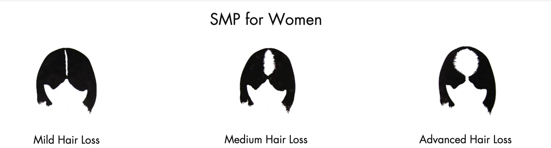 SMP for Women with three black silhouette head icons and labels: Male with hair, Female with hair, and Advanced hair loss