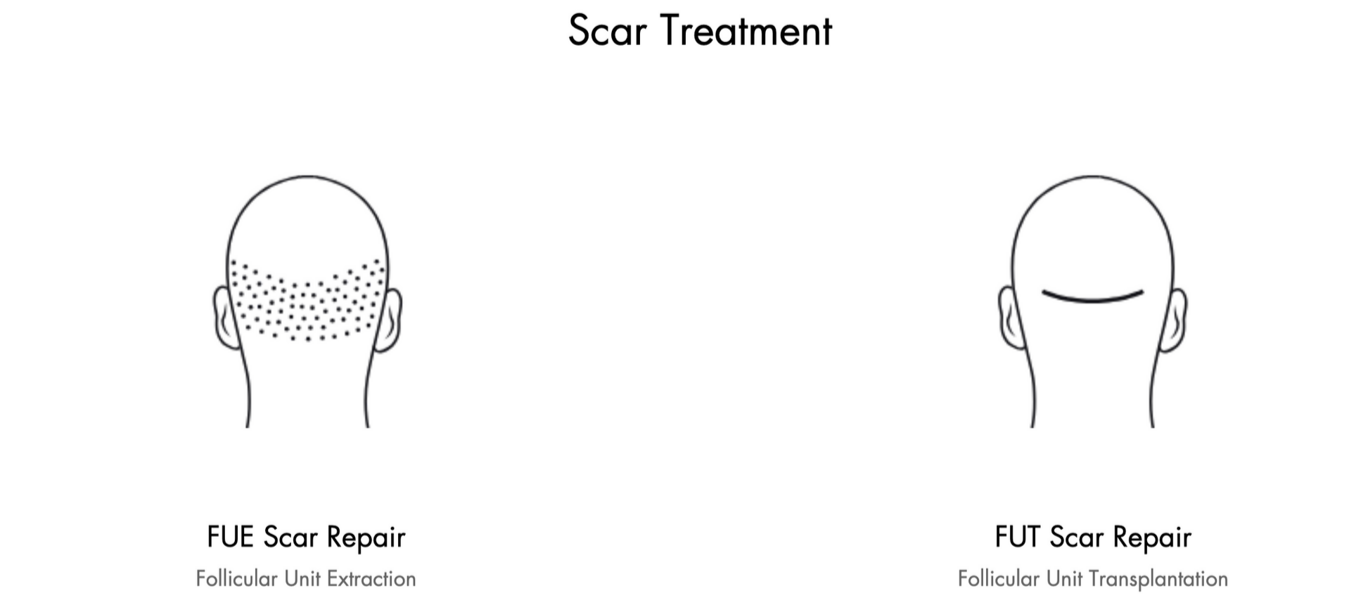 Scar treatment diagram showing a face with dotted scar lines and a side profile before-and-after comparison