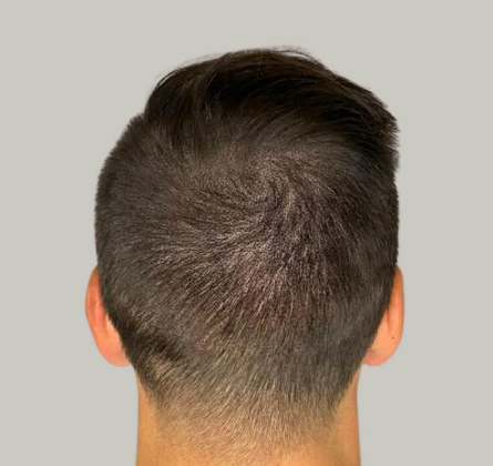 Back view of a person with short dark hair and closely shaved sides against a plain background