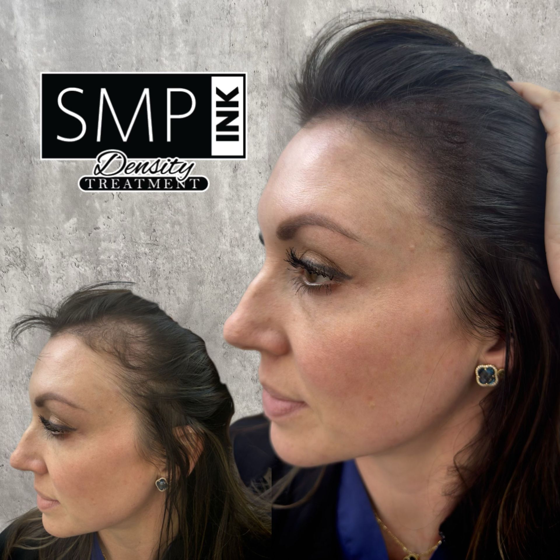Before-and-after profile photos showing denser hair treatment results, with “SMP Ink” logo.