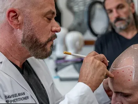 Doctor marking a bald scalp with a brush during a medical procedure, with an assistant in the background