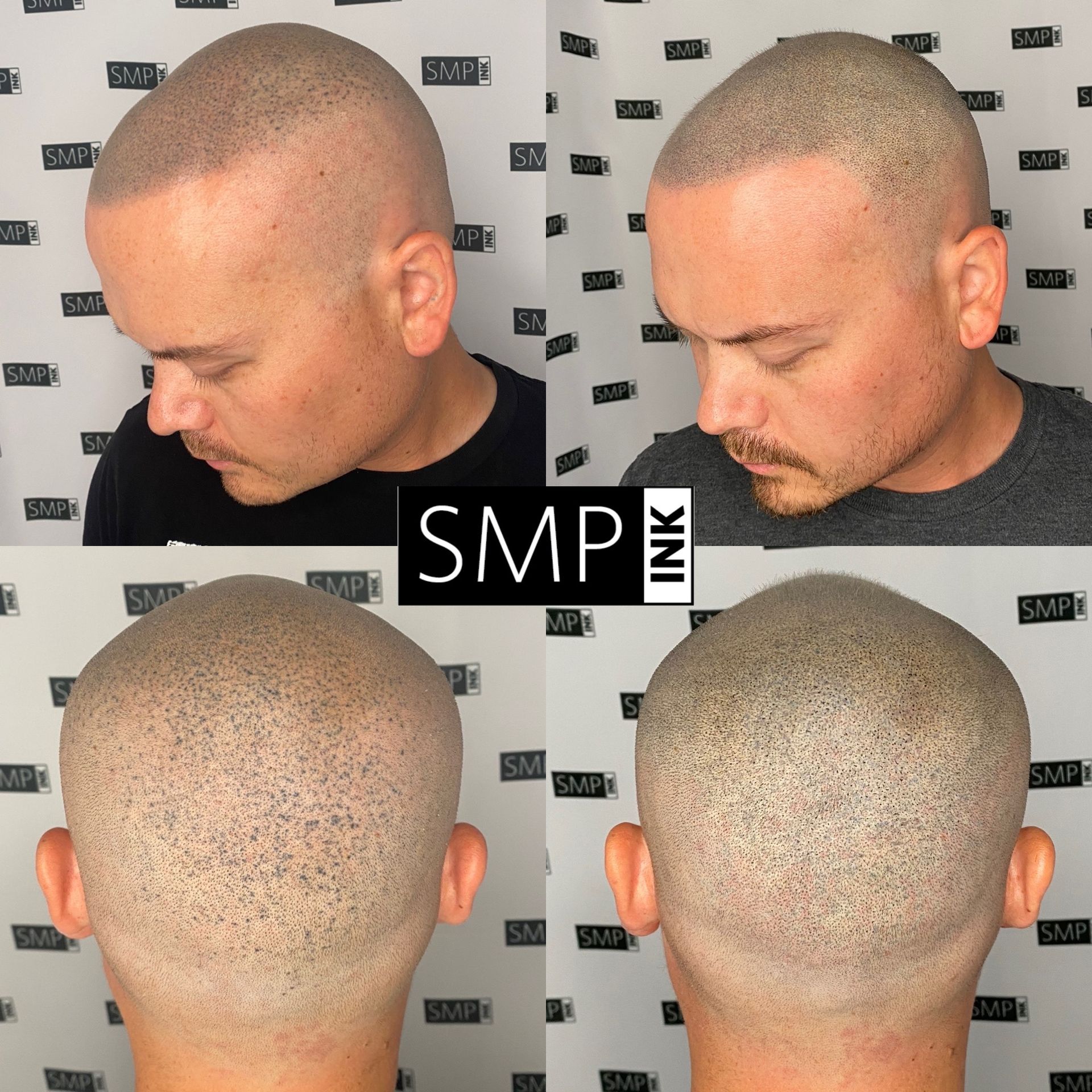 Results of SMP Correctionis