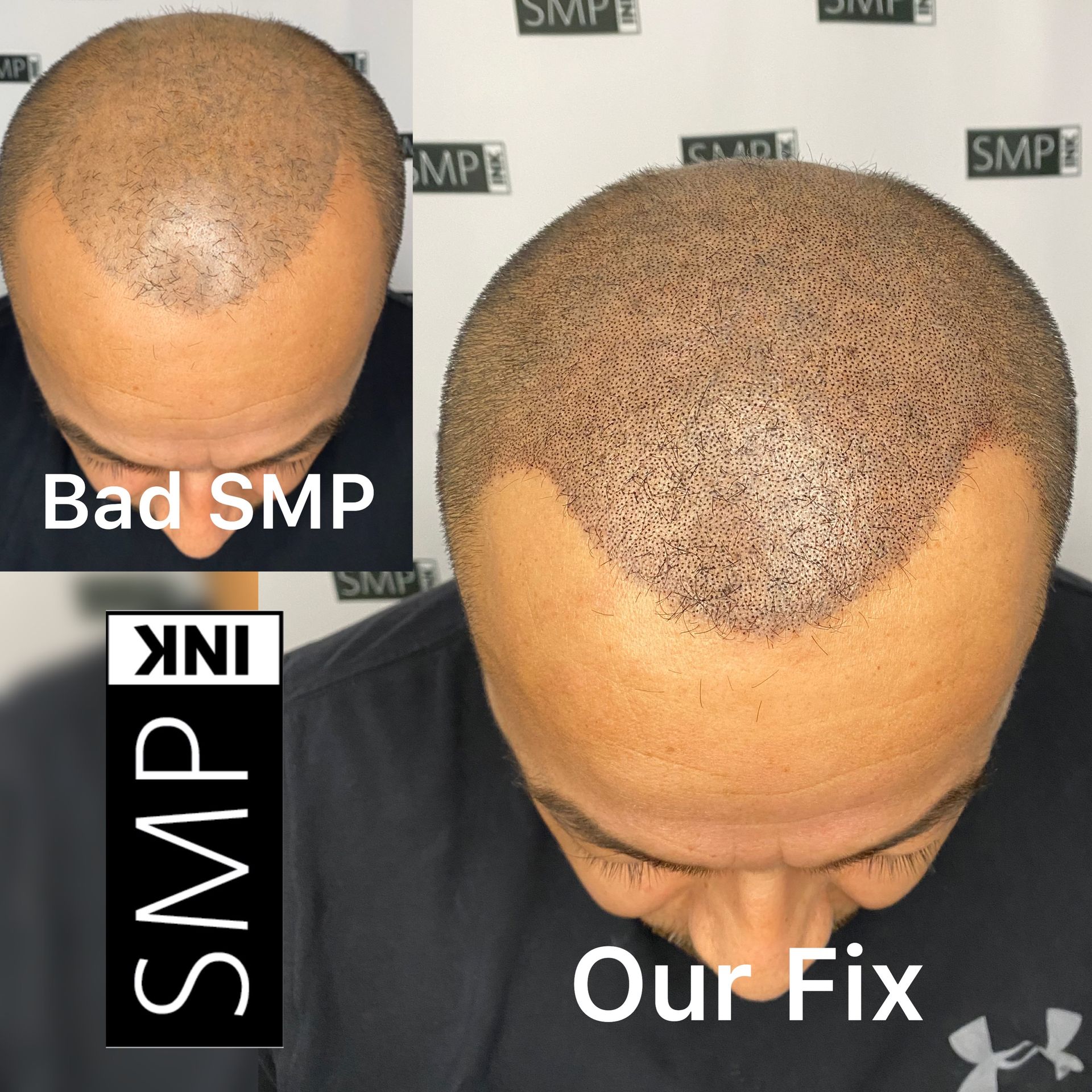 Client result of Results of SMP Correction fixing bad SMP results