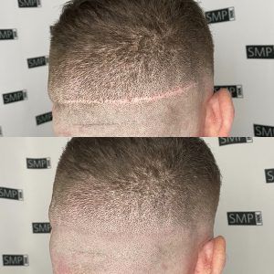 SMP Inc CDA scar camouflage