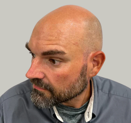 Bald man with a beard in a gray shirt looking to the left