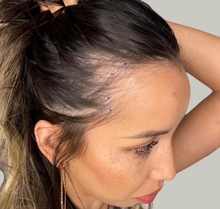 Close-up of a woman with dark hair in a bun, touching her head and wearing gold earrings.