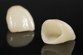 Close-up of a woman getting her teeth examined by a gloved dentist