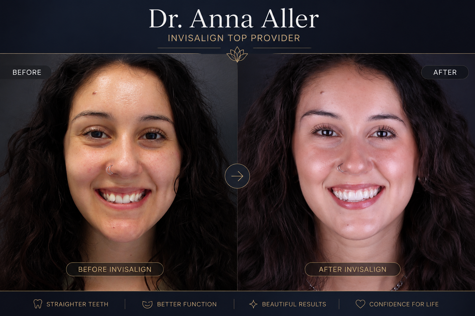 Before-and-after smile photos showing brighter teeth, with Dr. Anna Aller branding at top.