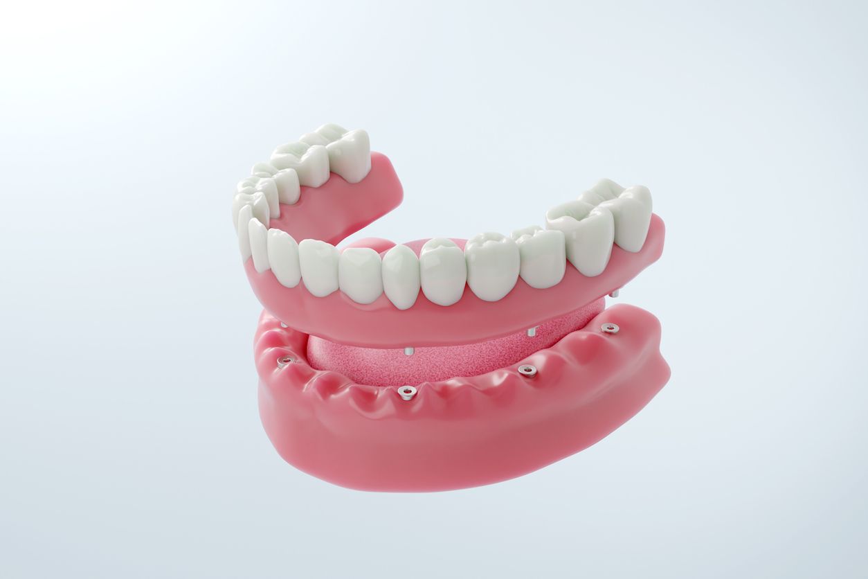 A set of dentures, pink base with white teeth, isolated on a light background.