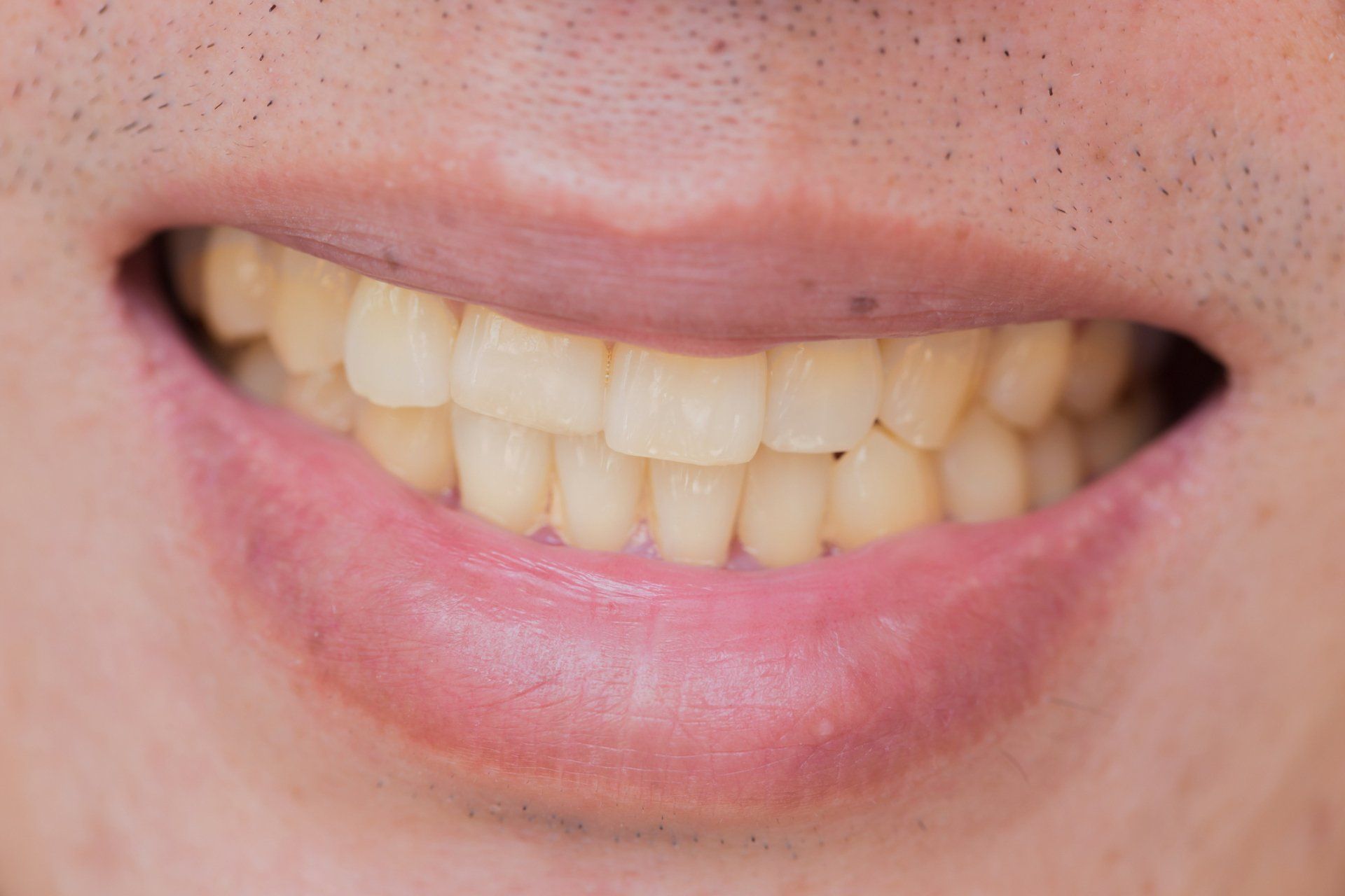A close up of a man 's mouth with white teeth.